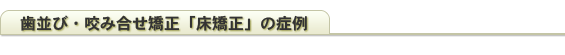 歯並び・咬み合せ矯正「床矯正」の症例
