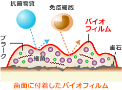 バイオフィルム