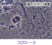 細菌：スピロヘータ