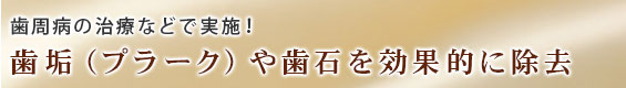 白く輝くきれいな歯を追求する治療