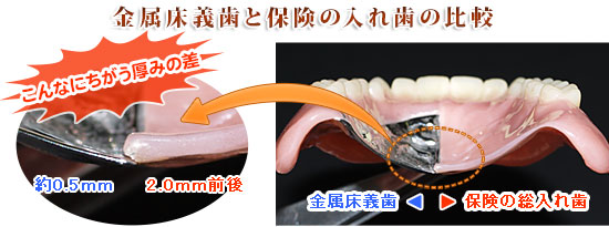 自費診療でつくる入れ歯・義歯