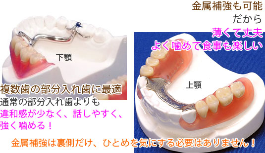 歯科用金属・コバルトクロム（Co-Cr）で補強した丈夫な部分入れ歯！