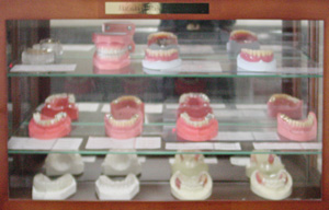 入れ歯のサンプル模型